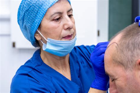 Haartransplantatie En Sociale Acceptatie